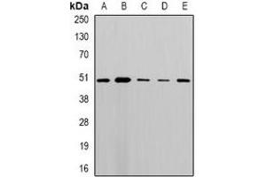 Western blot analysis of MLN64 expression in MCF7 (A), A549 (B), mouse lung (C), mouse heart (D), rat brain (E) whole cell lysates. (STARD3 antibody)