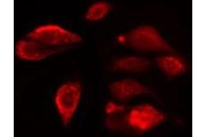 ABIN6275472 staining  COLO205 cells by IF/ICC. (WTH3DI antibody)