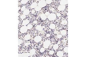 Immunohistochemical analysis of paraffin-embedded Human marrow tissue using A performed on the Leica® BOND RXm. (TAL1 antibody  (AA 68-97))