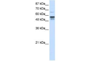 WB Suggested Anti-FOXG1B Antibody Titration:  1. (FOXG1 antibody  (N-Term))