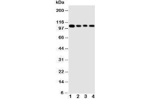 Western blot testing of HSP105 antibody and Lane 1:  rat ovary ;  2: A549 cell  lysate;  3: U87 cell  lysate;  4: HeLa cell  lysate