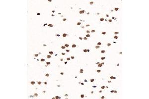 Immunohistochemistry of paraffin embedded rat brain using ZNF682 (ABIN7076270) at dilution of 1:1200 (400x lens) (ZNF682 antibody)