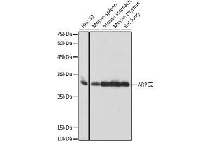 Western blot analysis of extracts of various cell lines, using  antibody (ABIN7265385) at 1:1000 dilution. (ARPC2 antibody)