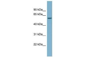 PPP5C antibody used at 1 ug/ml to detect target protein. (PP5 antibody  (N-Term))
