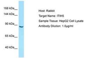 Image no. 1 for anti-Inter alpha Globulin Inhibitor H5 (ITIH5) (AA 77-126) antibody (ABIN6750010) (ITIH5 antibody  (AA 77-126))