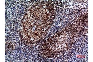 Immunohistochemistry (IHC) analysis of paraffin-embedded Human Tonsil, antibody was diluted at 1:100. (PAX5 antibody  (Internal Region))