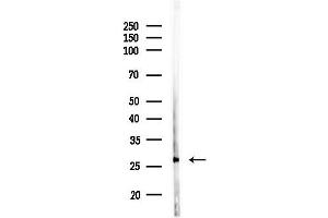 Western blot analysis of lysates from Rat liver, using OR51I2 Antibody at 1/1000 dilution.
