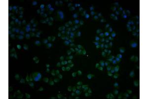 Immunofluorescence staining of Hela cells with ABIN7148793 at 1:100, counter-stained with DAPI. (ATF4 antibody  (AA 20-200))