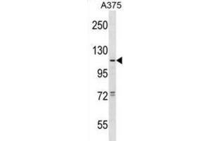 Western Blotting (WB) image for anti-Taste Receptor, Type 1, Member 1 (TAS1R1) antibody (ABIN2998828) (TAS1R1 antibody)