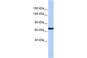 Western Blotting (WB) image for anti-Protocadherin-15 (PCDH15) antibody (ABIN2463319) (PCDH15 antibody)