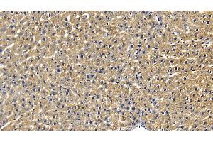 Immunohistochemistry (IHC) image for anti-Receptor (TNFRSF)-Interacting serine-threonine Kinase 1 (RIPK1) (AA 1-179) antibody (ABIN7441205)