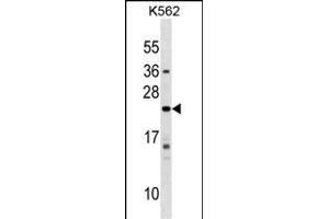 IFNA10 Antibody (C-term) (ABIN1536759 and ABIN2849164) western blot analysis in K562 cell line lysates (35 μg/lane). (IFNA10 antibody  (C-Term))
