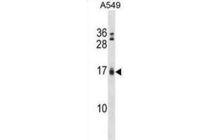 Western Blotting (WB) image for anti-BCL2-Interacting Killer (Apoptosis-Inducing) (BIK) (BH3 Domain) antibody (ABIN2997206) (BIK antibody  (BH3 Domain))