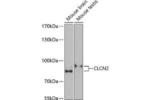 Western blot analysis of extracts of various cell lines, using CLCN2 Antibody (ABIN6133641, ABIN6138663, ABIN6138664 and ABIN6221716) at 1:1000 dilution. (CLCN2 antibody  (C-Term))