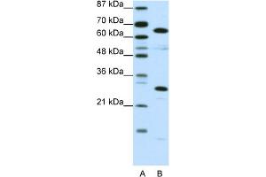 WB Suggested Anti-HMGB4 Antibody Titration:  0. (HMGB4 antibody  (C-Term))