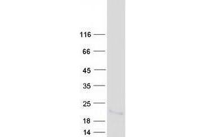 Validation with Western Blot (Trefoil Factor 2 Protein (TFF2) (Myc-DYKDDDDK Tag))