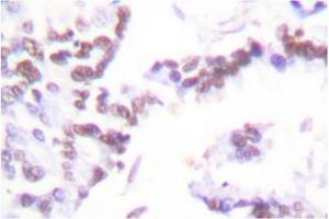 Image no. 2 for anti-Cyclin G1 (CCNG1) antibody (ABIN265382)
