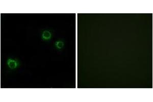 Immunofluorescence analysis of HuvEc cells, using CLDN6 Antibody.