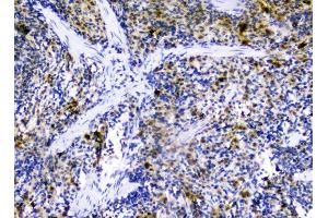 IHC analysis of CXCL12 using anti-CXCL12 antibody (ABIN6719467). (CXCL12 antibody  (AA 24-93))
