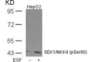 Western blot analysis of extracts from HepG2 cells untreated or treated with EGF using SEK1/MKK4(Phospho-Ser80) Antibody. (MAP2K4 antibody  (pSer80))