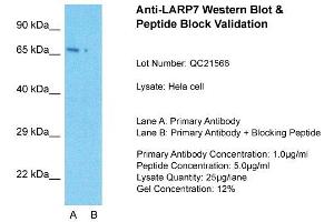Host: Rabbit  Target Name: LARP7  Sample Tissue: Hela Whole cell  Lane A:  Primary Antibody Lane B:  Primary Antibody + Blocking Peptide Primary Antibody Concentration: 1 µg/mL Peptide Concentration: 5 µg/mL Lysate Quantity: 41 µg/laneGel Concentration:. (LARP7 antibody  (C-Term))