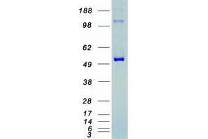 Validation with Western Blot (CDK8 Protein (Myc-DYKDDDDK Tag))