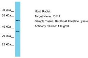 Image no. 1 for anti-Ring Finger Protein 14 (RNF14) (AA 161-210) antibody (ABIN6750275) (RNF14 antibody  (AA 161-210))