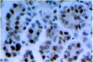 Immunohistochemistry (IHC) image for anti-RAD17 (RAD17) antibody (ABIN492574) (RAD17 antibody)