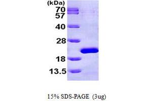 SDS-PAGE (SDS) image for Eukaryotic Translation Initiation Factor 1A, X-Linked (EIF1AX) (AA 1-144) protein (His tag) (ABIN667210)