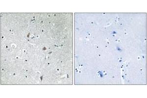 Immunohistochemistry analysis of paraffin-embedded human brain, using mTOR (Phospho-Ser2448) Antibody. (MTOR antibody  (pSer2448))