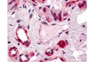 Immunohistochemicval staining on human colon (Submucosal Plexus and Submucosal Vessels) paraffin sections using CRLR antibody ABIN122018. (CALCRL antibody  (Cytoplasmic Domain))