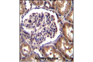 TLL2 Antibody (N-term) (ABIN392519 and ABIN2842079) immunohistochemistry analysis in formalin fixed and paraffin embedded human kidney tissue followed by peroxidase conjugation of the secondary antibody and DAB staining. (Tolloid-Like 2 antibody  (N-Term))