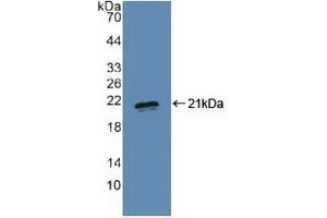 Detection of Recombinant PRDM1, Human using Polyclonal Antibody to PR Domain Containing Protein 1 (PRDM1) (PRDM1 antibody  (AA 29-149))
