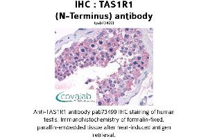 Image no. 1 for anti-Taste Receptor, Type 1, Member 1 (TAS1R1) (Extracellular Domain), (N-Term) antibody (ABIN1739915) (TAS1R1 antibody  (Extracellular Domain, N-Term))