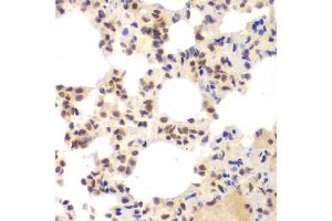 Immunohistochemistry of paraffin-embedded mouse lung using CSNK2 antibody (ABIN6127663, ABIN6139128, ABIN6139129 and ABIN6217497) at dilution of 1:100 (40x lens). (CSNK2A2 antibody  (AA 1-350))