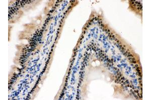 Anti- HINT1 Picoband antibody, IHC(P) IHC(P): Mouse Intestine Tissue (HINT1 antibody  (Middle Region))