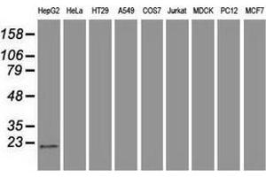 Western blot analysis of extracts (35 µg) from 9 different cell lines by using anti-AK1 monoclonal antibody. (Adenylate Kinase 1 antibody)