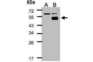 WB Image Western Blot analysis of NR2F1 expression in transfected 293T cell line by NR2F1 polyclonal antibody. (NR2F1 antibody  (N-Term))
