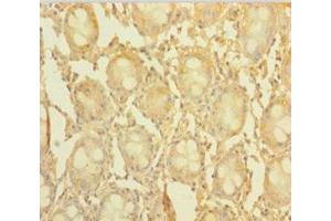Immunohistochemistry of paraffin-embedded human colon tissue using ABIN7148176 at dilution of 1:100 (CCDC94 antibody  (AA 1-279))