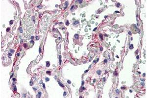 Human Lung (formalin-fixed, paraffin-embedded) stained with IL27 antibody ABIN337287 at 5 ug/ml followed by biotinylated goat anti-rabbit IgG secondary antibody ABIN481713, alkaline phosphatase-streptavidin and chromogen. (IL-27 antibody  (N-Term))