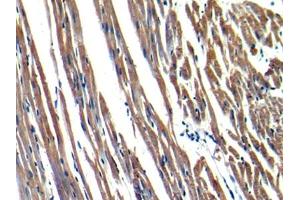 DAB staining on IHC-P; Samples: Rat Heart Tissue (MYH6 antibody  (AA 1747-1938))