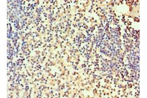 Immunohistochemistry of paraffin-embedded human spleen tissue using ABIN7146696 at dilution of 1:100 (CA1 antibody  (AA 1-261))