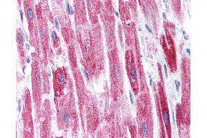 Anti-KCTD13 antibody IHC of human heart. (KCTD13 antibody  (AA 26-75))
