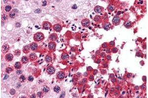 Human Testis: Formalin-Fixed, Paraffin-Embedded (FFPE) (RUVBL2 antibody  (AA 304-458))