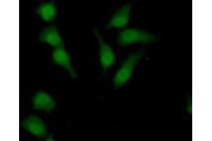 Detection of SULF2 in Human HepG2 Cells using Polyclonal Antibody to Sulfatase 2 (SULF2) (SULF2 antibody  (AA 337-649))