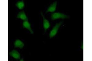 Detection of SULF2 in Human HepG2 Cells using Polyclonal Antibody to Sulfatase 2 (SULF2) (SULF2 antibody  (AA 337-649))