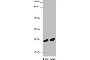 Western blot All lanes: PSPH antibody at 3. (PSPH antibody  (AA 1-225))