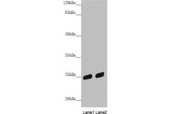 PSPH antibody  (AA 1-225)