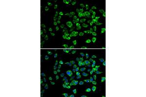 Immunofluorescence analysis of U2OS cells using PSMD13 antibody. (PSMD13 antibody)