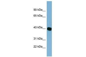 C14ORF148 antibody used at 1 ug/ml to detect target protein. (NOXRED1 antibody  (Middle Region))